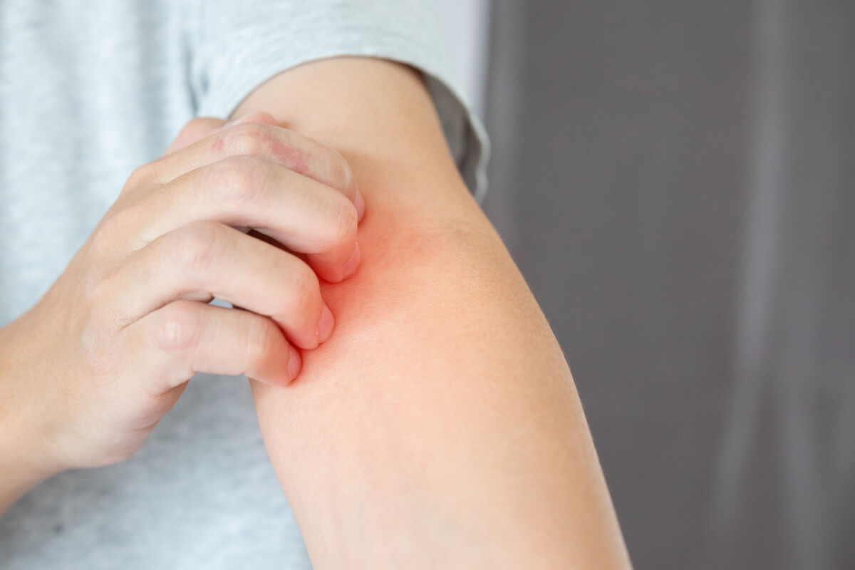 Asian man itching arm